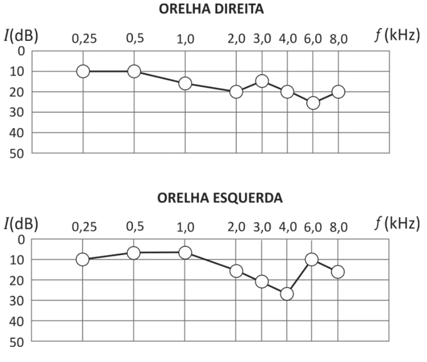 F1 Gráficos de audiometria das orelhas direita e esquerda, relacionando a intensidade mínima I em decibéis (dB) no eixo vertical invertido (0 a 50 dB) com a frequência f em kHz no eixo horizontal (0,25 a 8,0 kHz).