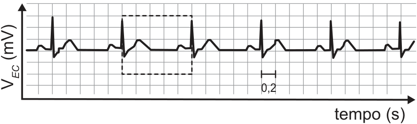 Gráfico quadriculado de eletrocardiograma mostrando a intensidade do sinal V_EC em mV em função do tempo em segundos, com um ciclo cardíaco delimitado por uma caixa tracejada e uma escala de tempo indicando 0,2 s.