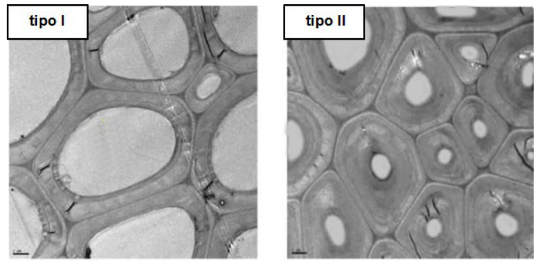 Microscopia eletrônica de tecido vegetal mostrando células de madeira do tipo I (com paredes celulares finas e lúmen amplo) e do tipo II (com paredes celulares muito espessas e lúmen estreito).
