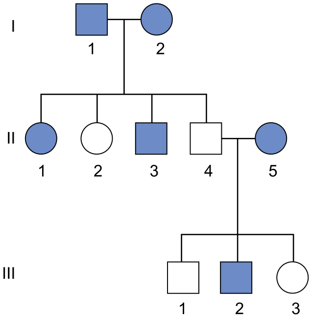 Heredograma de três gerações (I, II e III) representando indivíduos afetados preenchidos em azul e não afetados em branco. O casal I-1 e I-2, ambos afetados, tem quatro filhos: II-1 (mulher afetada), II-2 (mulher não afetada), II-3 (homem afetado) e II-4 (homem não afetado). O homem II-4 cruza com a mulher afetada II-5, gerando III-1 (homem não afetado), III-2 (homem afetado) e III-3 (mulher não afetada).