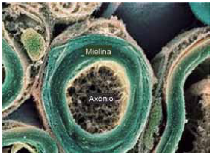 Micrografia eletrônica mostrando a seção transversal de uma fibra nervosa com o axônio no centro e a bainha de mielina ao redor.