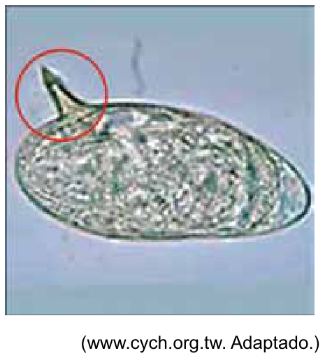 Micrografia óptica de um ovo do verme Schistosoma mansoni, de formato ovalado, apresentando espinho lateral destacado por um círculo vermelho; abaixo consta o crédito "(www.cych.org.tw. Adaptado.)".