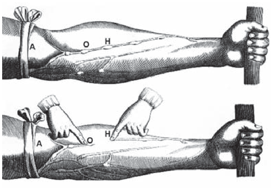 Ilustração histórica mostrando um braço com torniquete A e veias intumescidas com pontos O e H; na parte inferior, duas mãos pressionam e esvaziam o segmento venoso entre H e O.