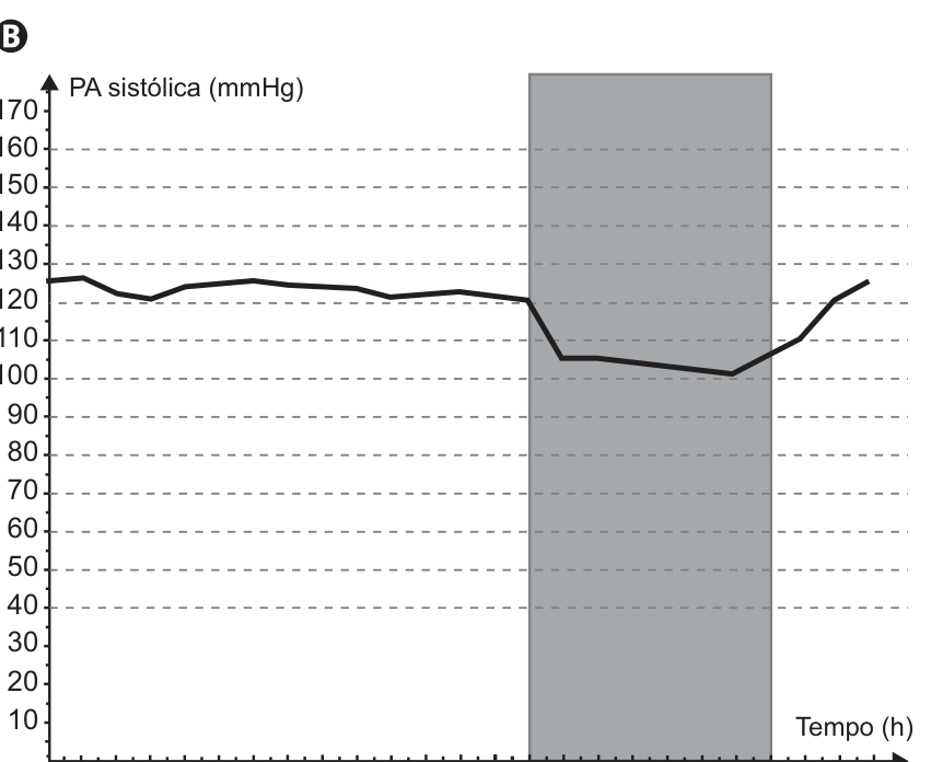 Gráfico da PA sistólica (mmHg) em função do tempo (h), de 0 a 24 horas. A região cinza corresponde ao período entre 14 e 21 horas. A pressão fica próxima de 120 a 125 mmHg antes desse período, cai para cerca de 100 a 105 mmHg durante ele e retorna a aproximadamente 125 mmHg ao final.