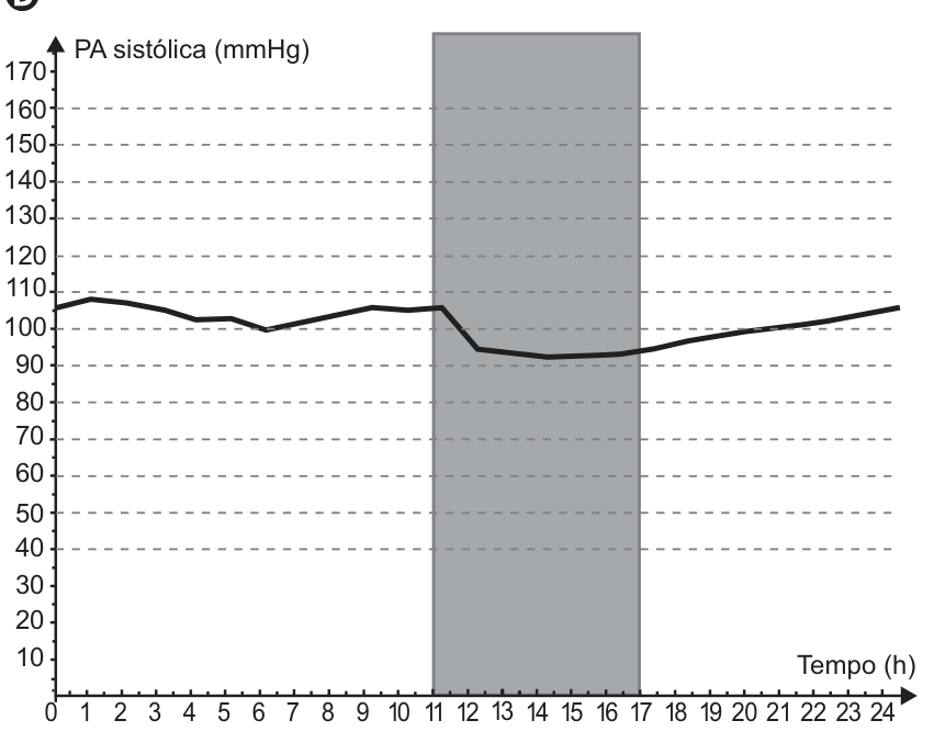 Gráfico da PA sistólica (mmHg) em função do tempo (h), de 0 a 24 horas. A região cinza corresponde ao período entre 11 e 17 horas. A pressão fica próxima de 100 a 108 mmHg antes desse período, cai para cerca de 92 a 95 mmHg durante ele e sobe gradualmente até aproximadamente 105 mmHg ao final.