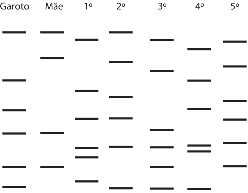 Padrão de bandas de DNA do teste de paternidade mostrando as colunas com fragmentos de DNA do Garoto, da Mãe e dos voluntários de 1º a 5º