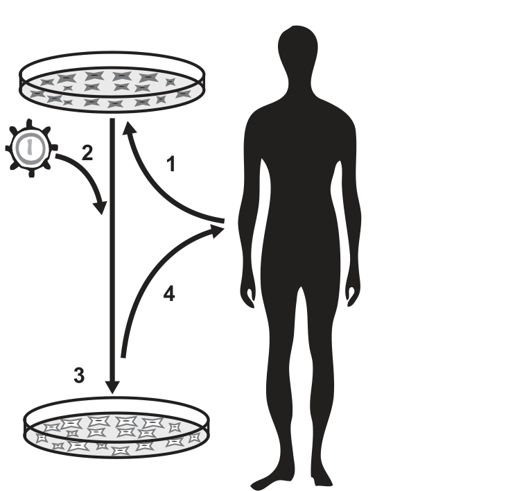Esquema representando as etapas da terapia gênica ex vivo: uma seta com o número 1 parte da silhueta de um indivíduo até uma placa de Petri com células. Uma partícula viral contendo material genético é indicada pelo número 2 e aponta para uma seta vertical que desce até uma segunda placa de Petri, indicada pelo número 3, contendo células com nova morfologia. Desta segunda placa, uma seta curva com o número 4 retorna para a silhueta do indivíduo.