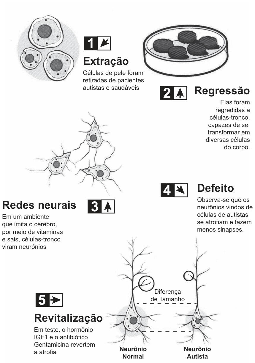 Infográfico em cinco etapas do experimento: 1 - Extração (células de pele de pacientes autistas e saudáveis); 2 - Regressão (regressão a células-tronco); 3 - Redes neurais (em ambiente que imita o cérebro, com vitaminas e sais, células-tronco viram neurônios); 4 - Defeito (neurônios de autistas se atrofiam e fazem menos sinapses); 5 - Revitalização (hormônio IGF1 e antibiótico Gentamicina revertem a atrofia, comparando Neurônio Normal e Neurônio Autista).