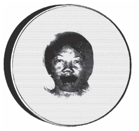 Bastidor de bordar circular com tecido esticado sobre o qual está transferida a imagem em preto e branco do rosto de uma mulher negra com a boca costurada por grossos fios pretos