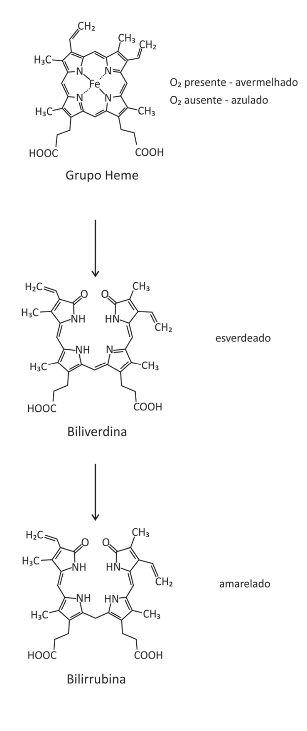 Esquema sequencial de transformação química do Grupo Heme (com indicações: O2 presente - avermelhado; O2 ausente - azulado) em Biliverdina (esverdeado) e esta em Bilirrubina (amarelado), acompanhado de suas respectivas fórmulas estruturais planas.